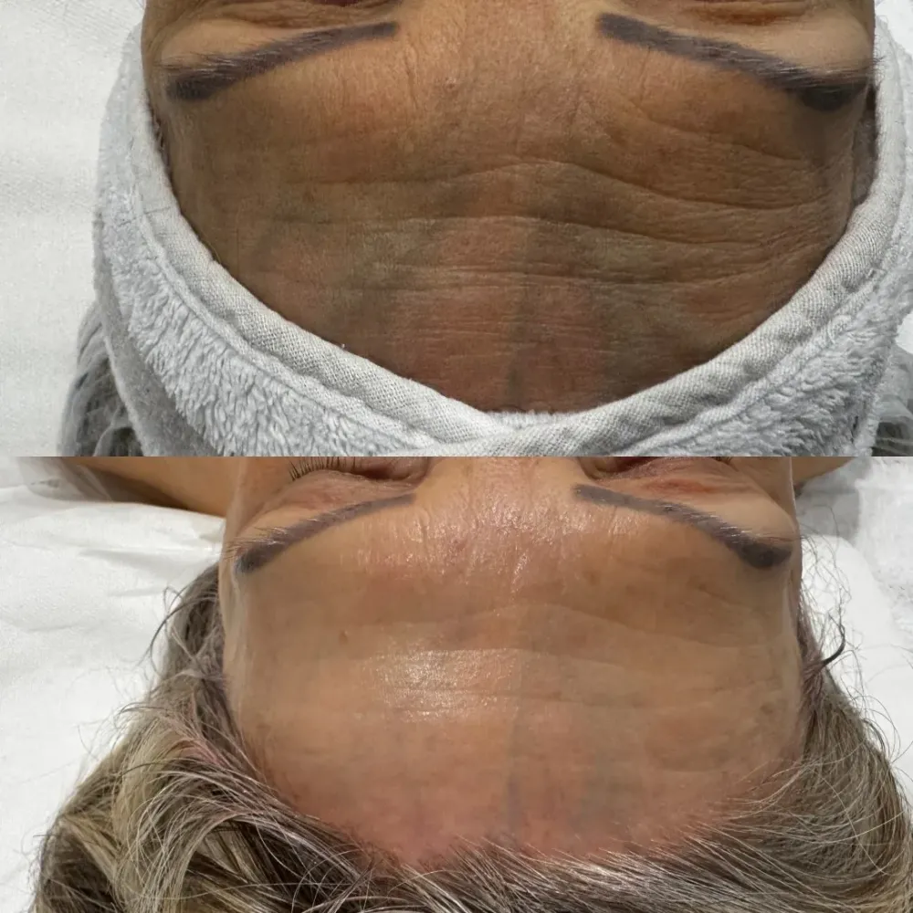 Soins visage ménopause à Maintenon